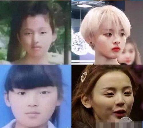 吃瓜爆料整容,整容背后的真相与争议